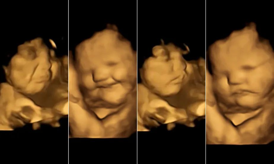 Acredite se quiser! Bebês reagem a sabores de alimentos com expressões faciais ainda na barriga da mãe, mostra estudo inédito