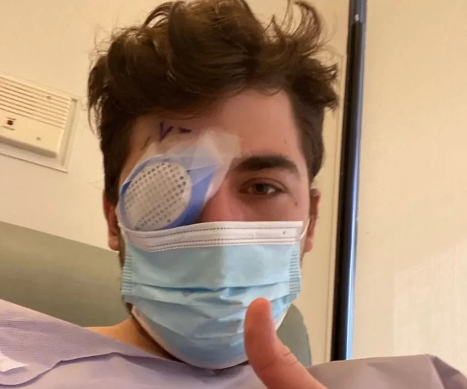 Homem de 21 anos fica cego de um olho por dormir 40 minutos com lentes de contato