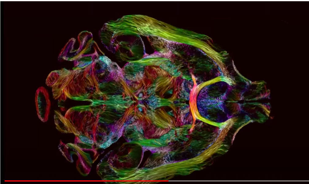 Estas são as imagens mais nítidas já feitas do interior de um cérebro humano (assista ao vídeo)