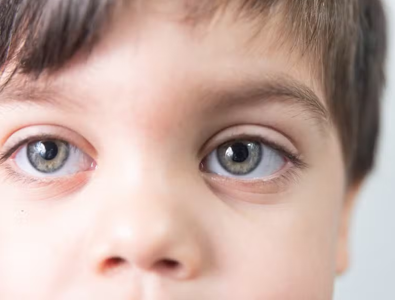 Novo método com inteligência artificial é capaz de diagnosticar autismo com 100% de acerto