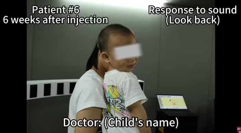 Crianças que nasceram surdas passam a ouvir graças a terapia genética inovadora