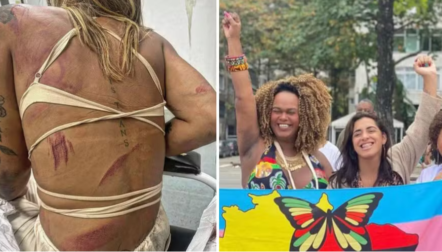 Assessora trans da vereadora Benny Briolly denuncia agressão em Cabo Frio