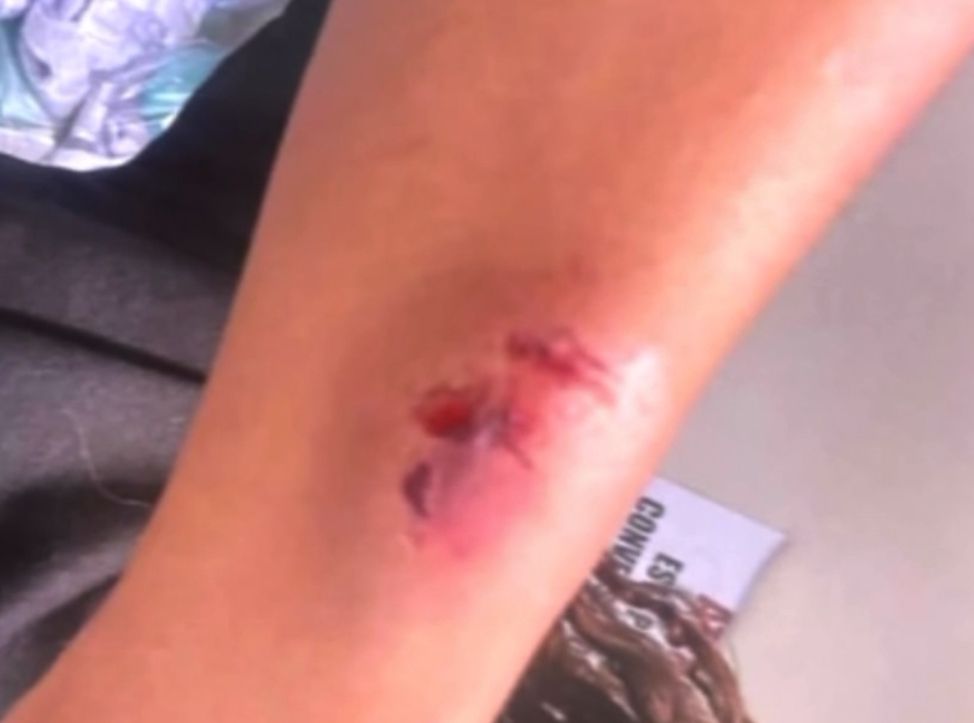 Woman bites cashier during altercation at Itaperuna supermarket