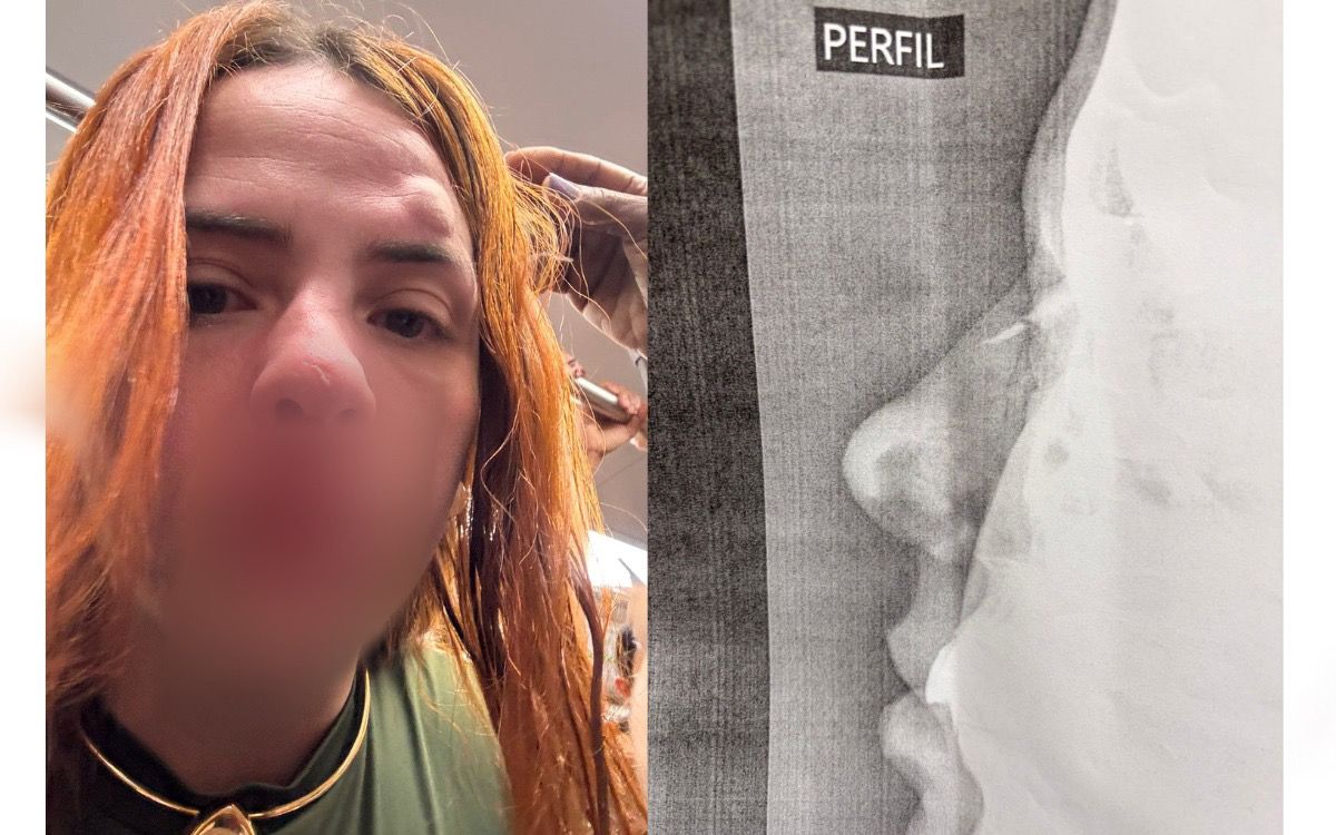 Briga em metrô do Rio por pisão no pé termina com mulher internada no CTI