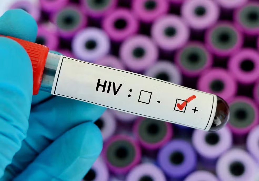 Quase 2 mil diagnósticos, uma epidemia ainda viva: o retrato do HIV no Rio em 2025