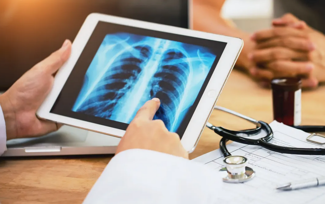 Explosão de casos de síndrome respiratória no Rio dispara alerta e pressiona hospitais