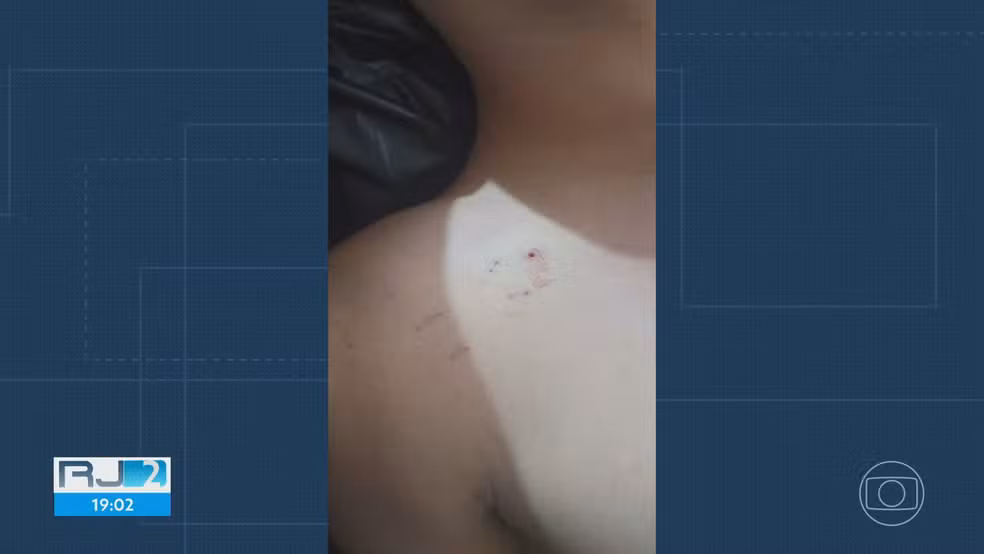 Adolescente morre após suspeita de picada de cobra em Itaguaí