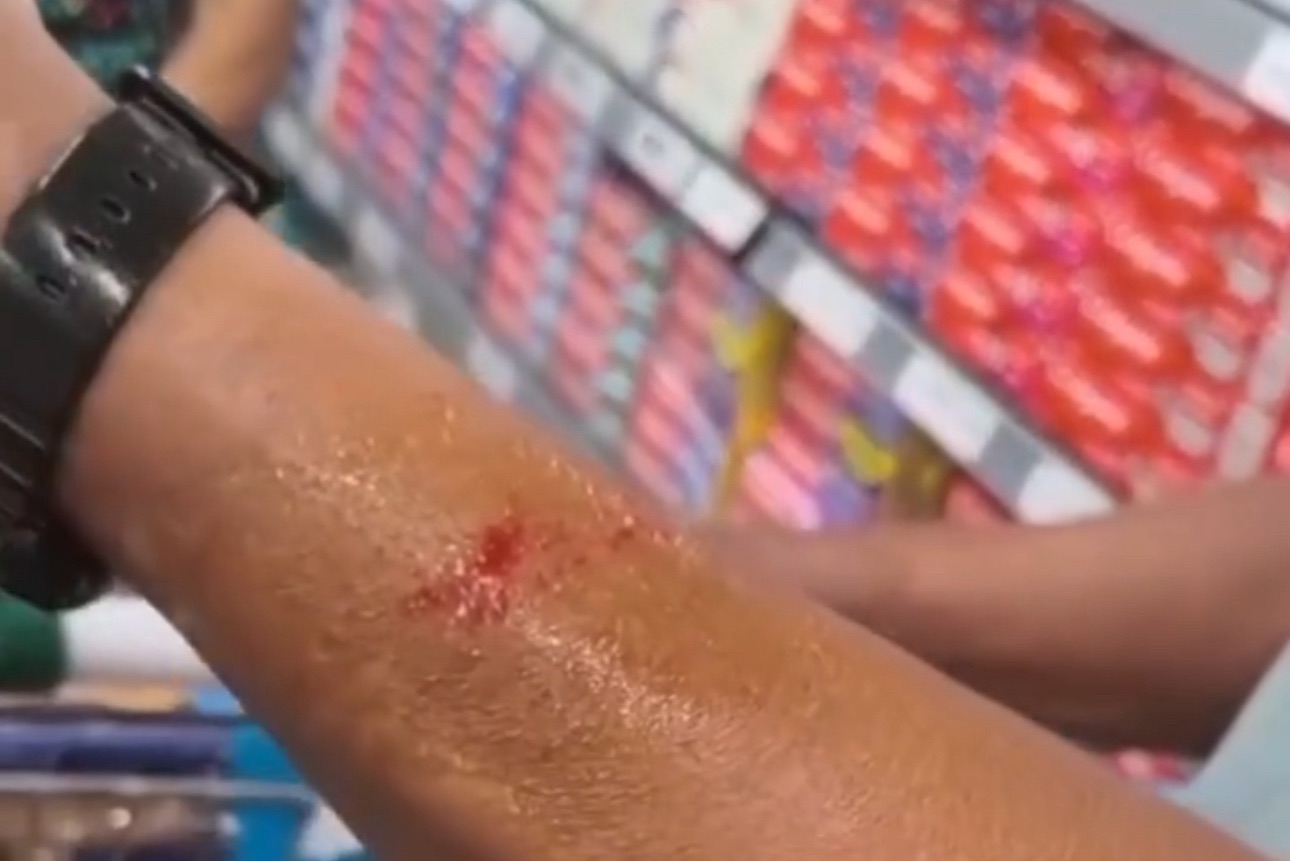 Vídeo: cliente diz ter sido atingido por ninho de ratos em supermercado de Niterói