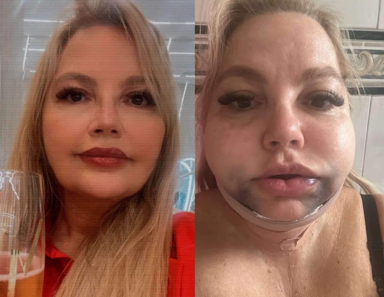 Tornozeleira eletrônica: Justiça impõe novas medidas a dentista acusada de lesão