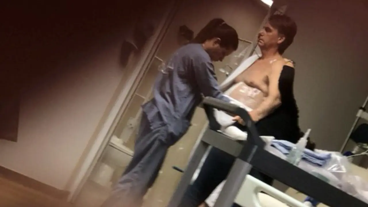 Bolsonaro deve passar por nova cirurgia após laudo enviado ao STF