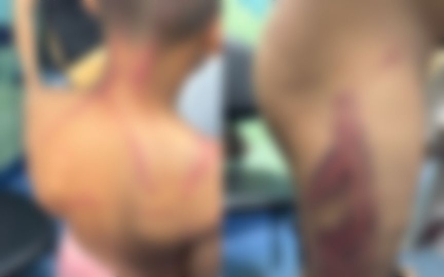 Casal é preso por tortura contra criança de 9 anos em São João de Meriti