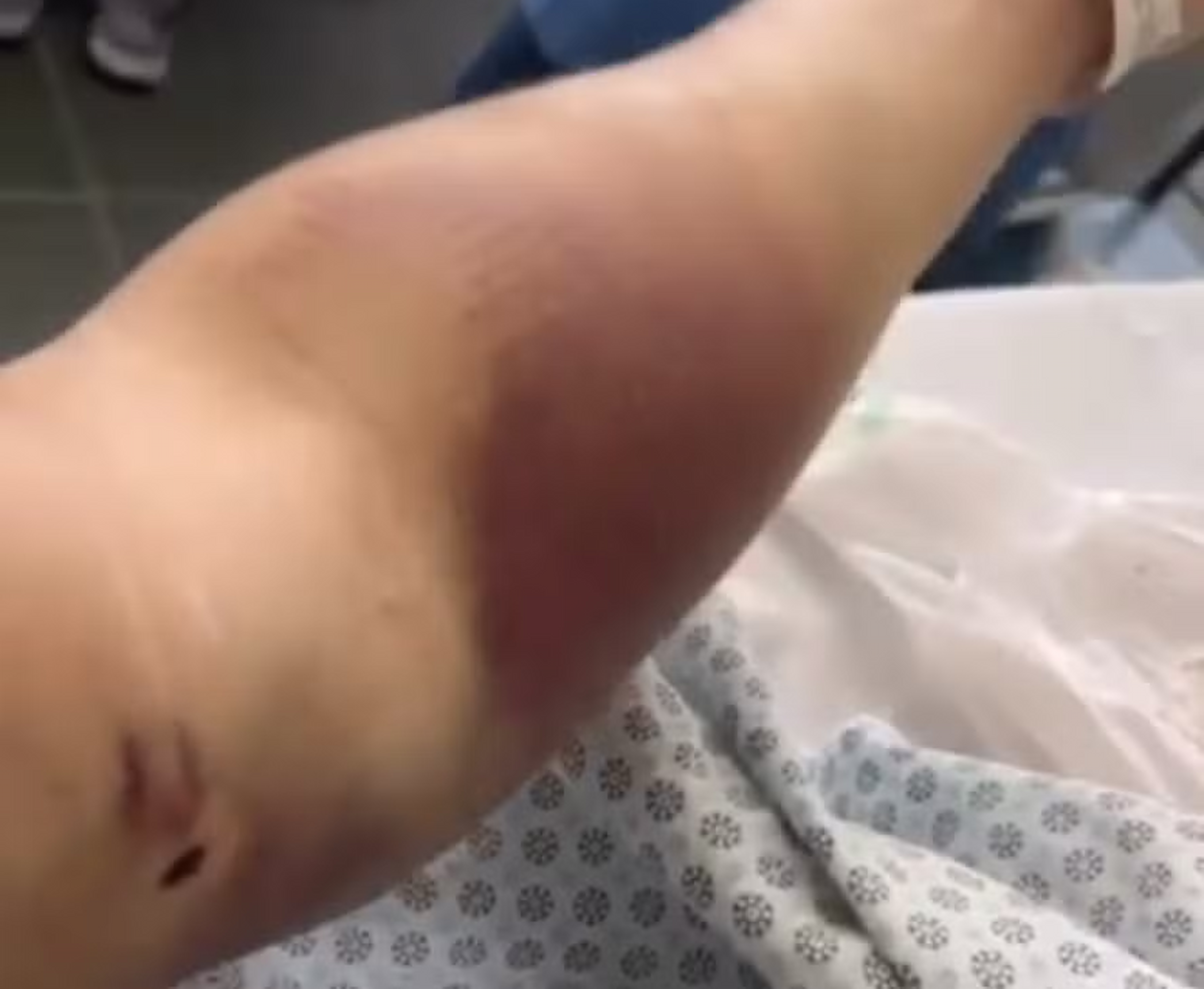 Turista canadense torturado no Rio segue internado enquanto no Souza Aguiar