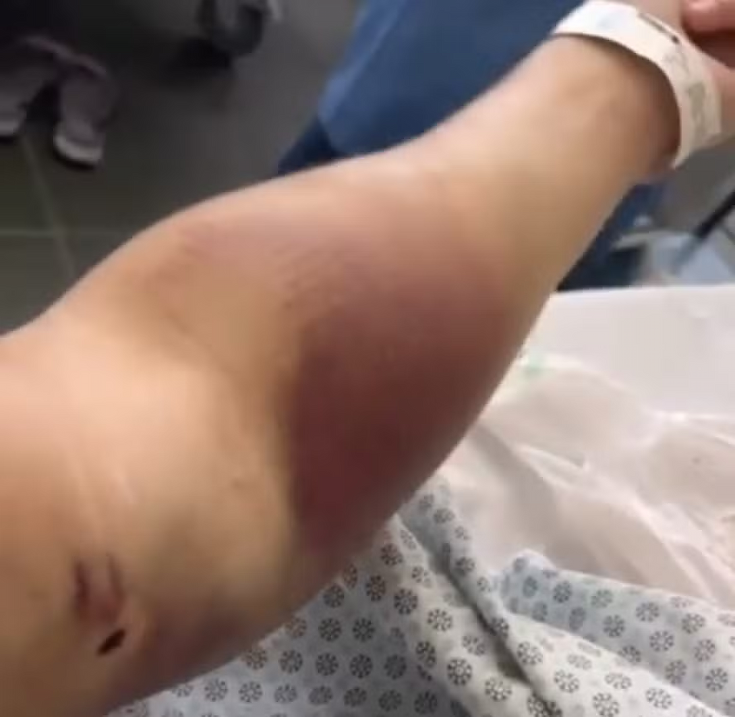 Turista canadense torturado no Rio segue internado enquanto no Souza Aguiar