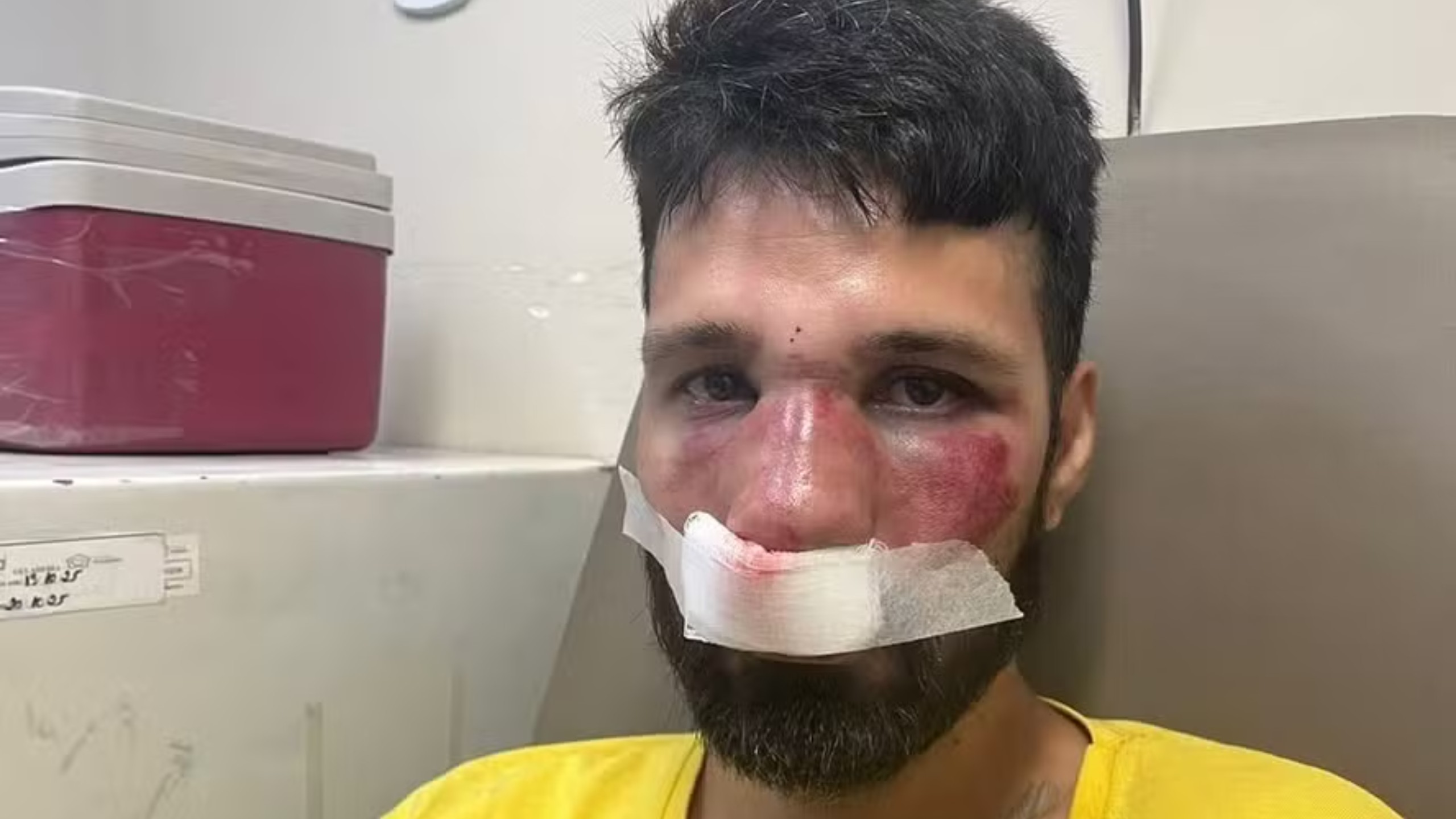 DJ é confundido com ladrão de bicicleta e agredido por entregadores no dia de aniversário
