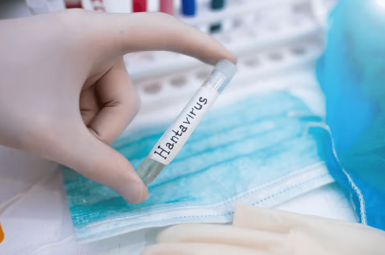 Adulto morre de hantavírus no Colorado, dizem autoridades de saúde dos EUA
