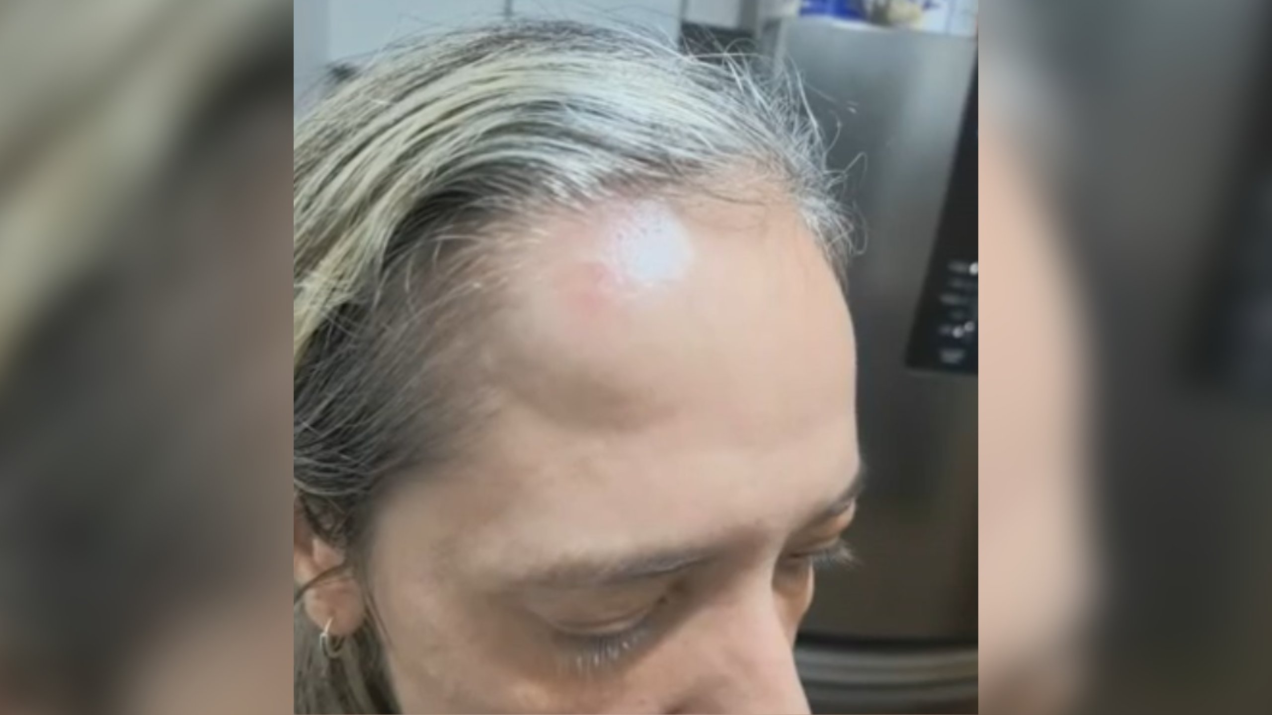 Mulher diz ter sido agredida por motociclista de aplicativo na Zona Sul