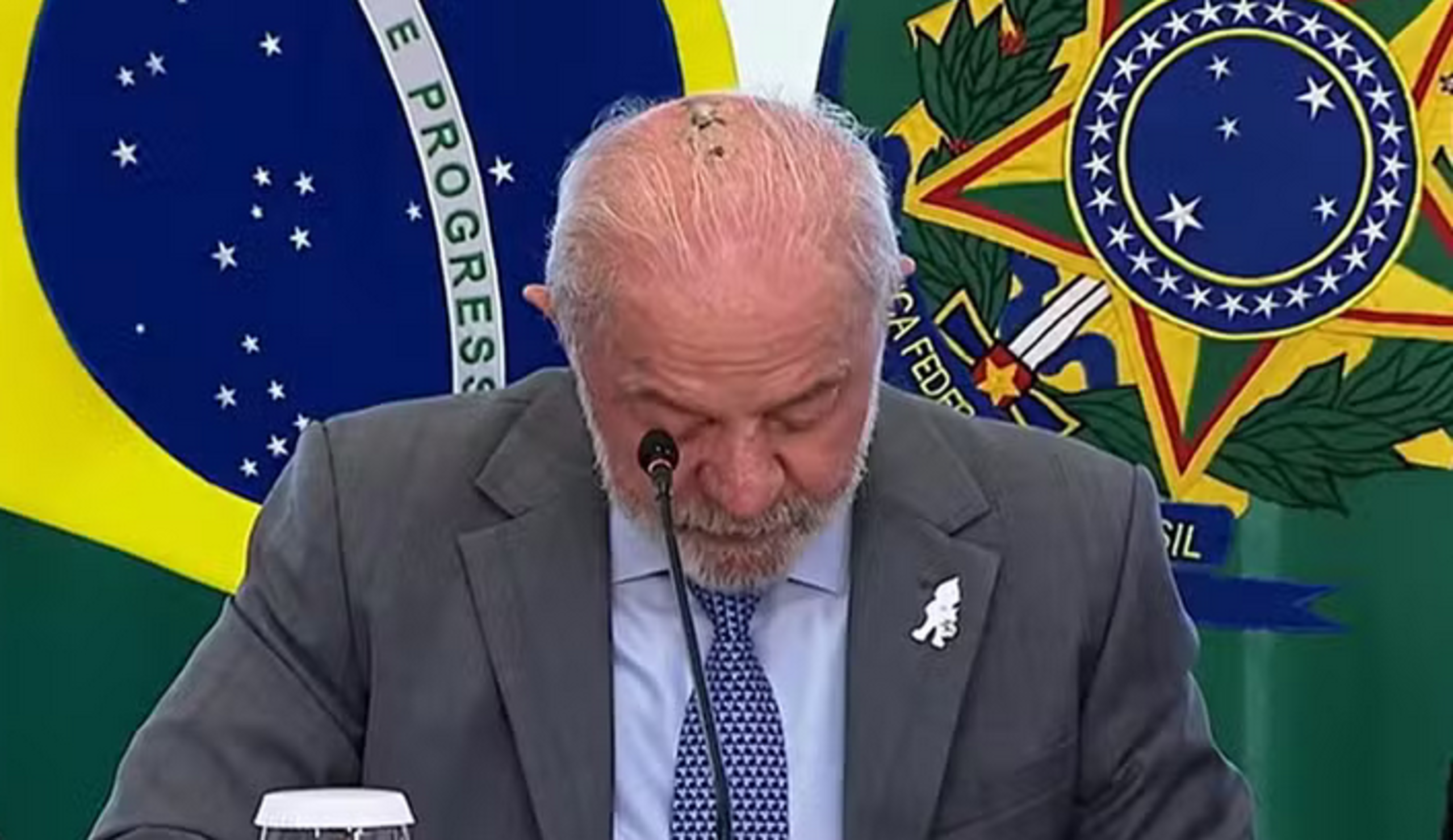 Lula faz segunda sessão de radioterapia preventiva no couro cabeludo, mas não cancela agenda