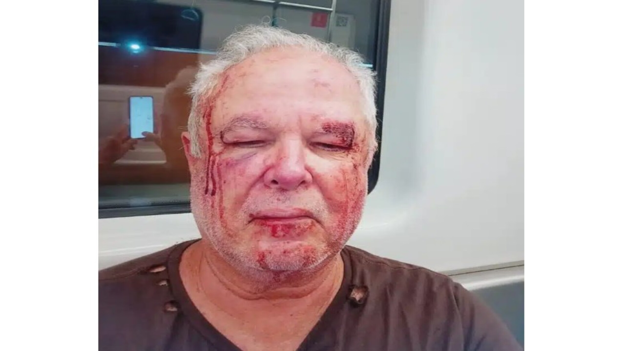 Petista de 69 anos é agredido em Copacabana e relata ataque motivado por divergências políticas