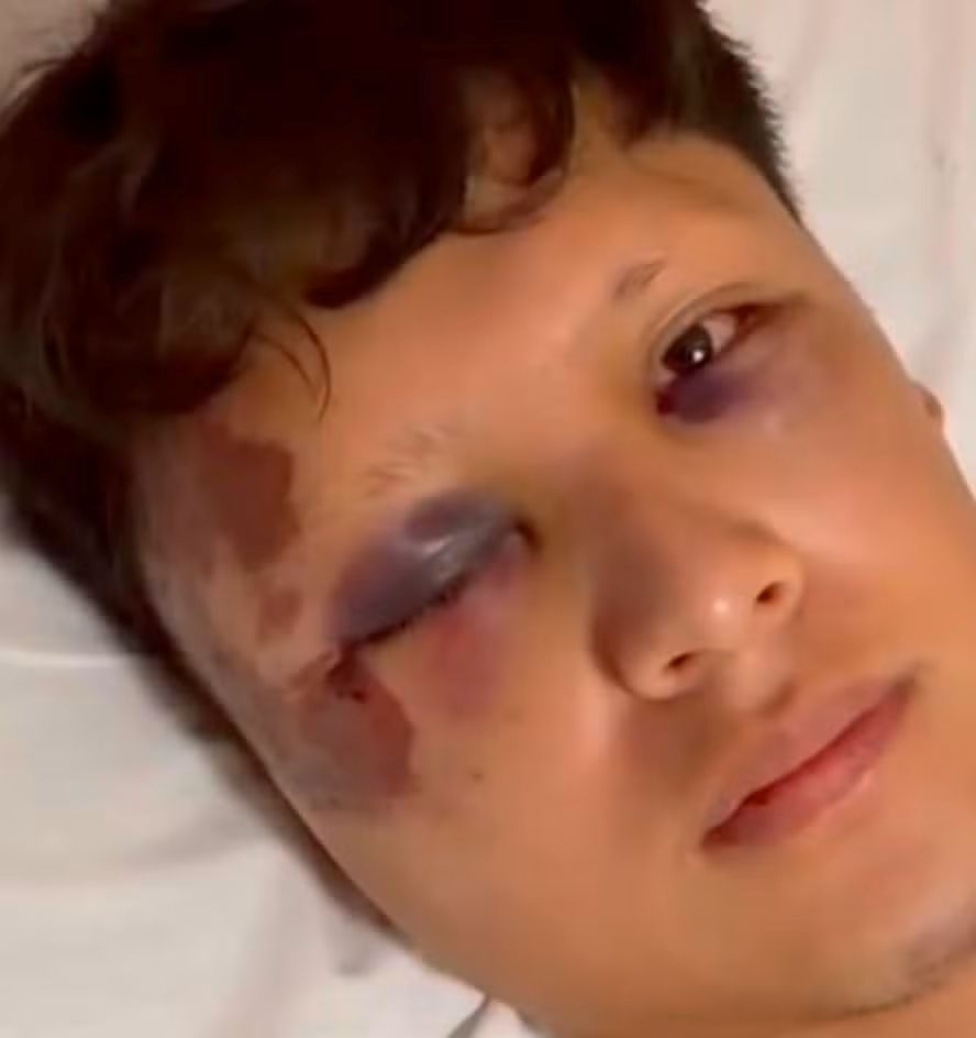 Turista mexicano é espancado em Copacabana e acaba hospitalizado