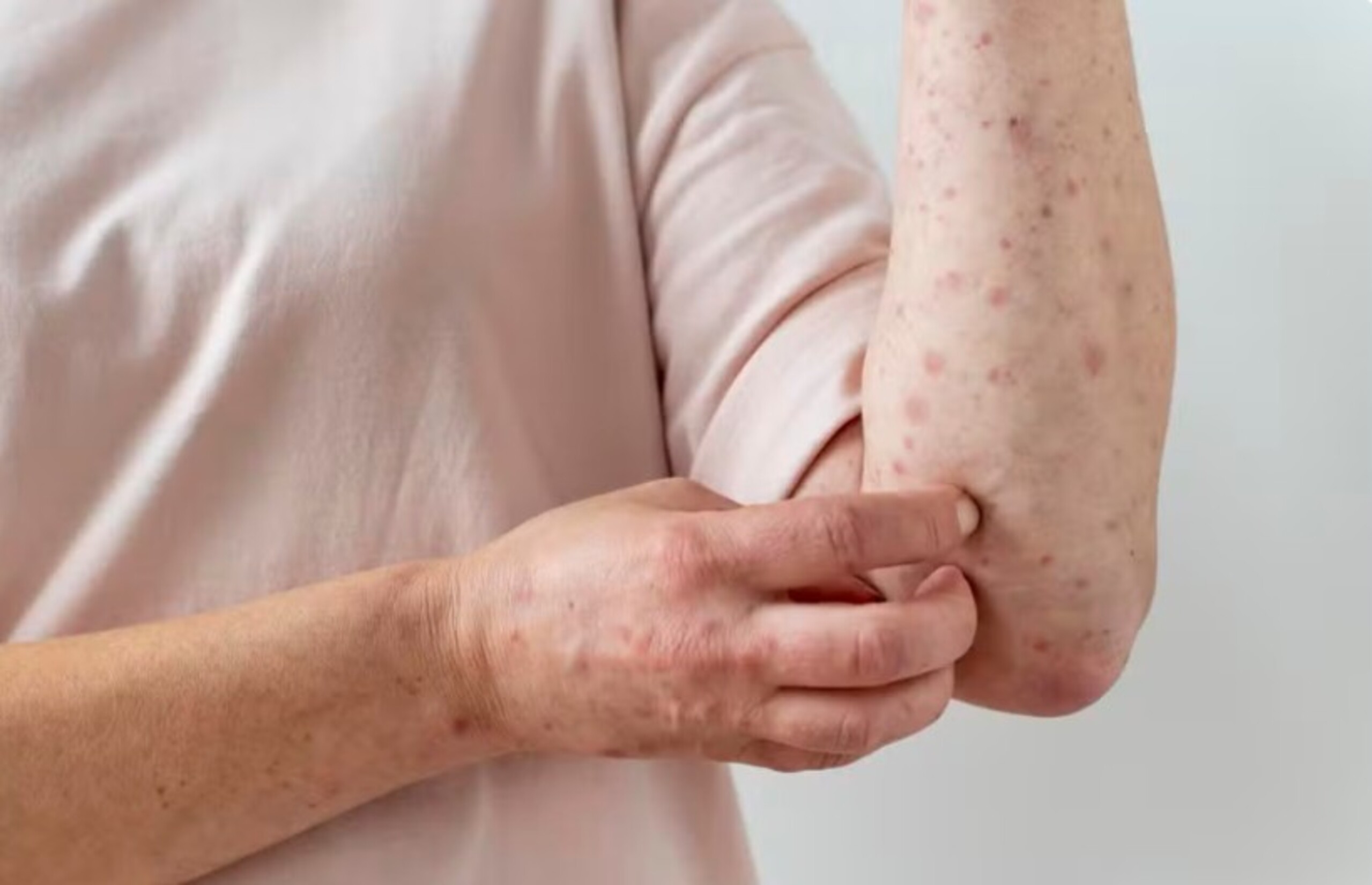 Photo : Agenda do Poder Aucun État brésilien n'atteint l'objectif de vaccination contre le sarampo